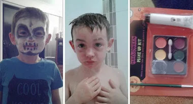 Mum claims Halloween makeup kit from Woolies ‘severely burnt’ her boy’s face