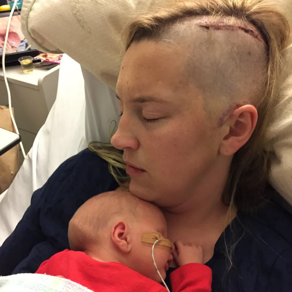 Felicity Plew had brain surgery shortly after giving birth to her beautiful boy Jesse