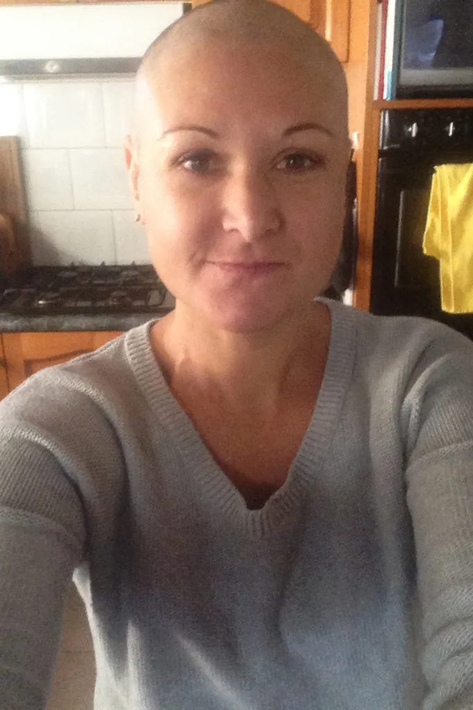 Kyle after treatment.