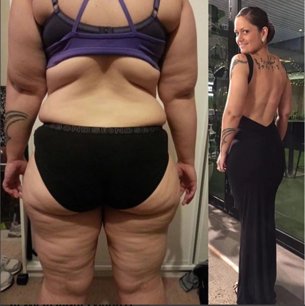 before and after