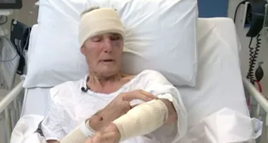 Grandfather left with smashed skull after intruder broke into his home