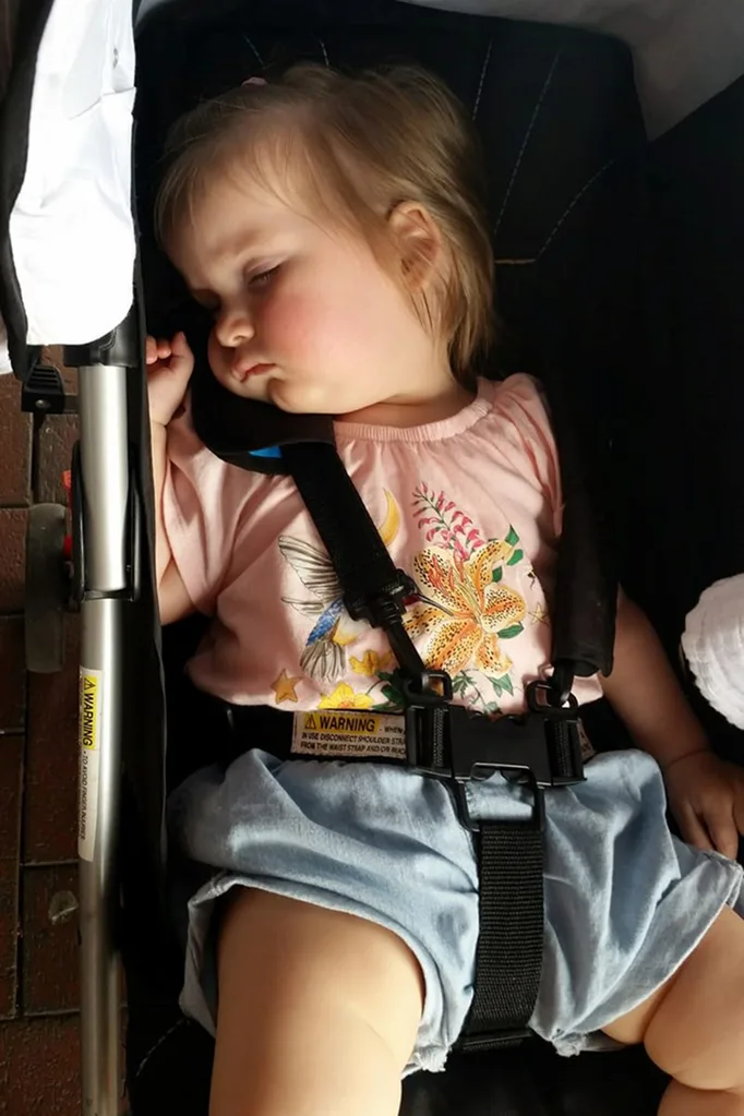 The mother's instinct led her daughter to be diagnosed with Craniosynotisis