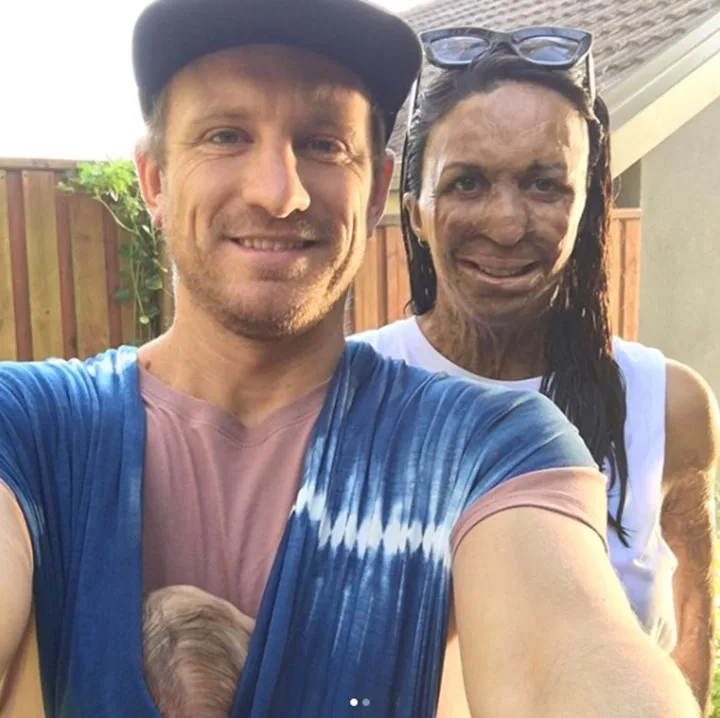 turia pitt and hubby