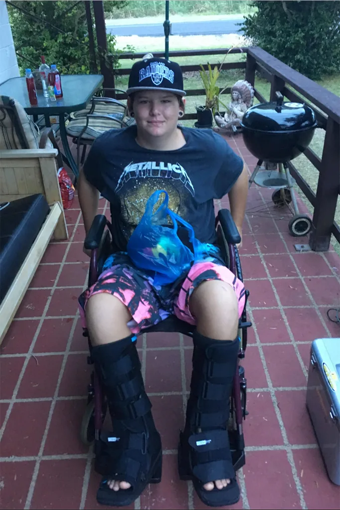 Jesse recovering with his two broken feet
