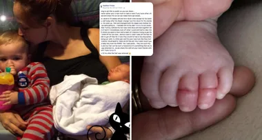 Mum’s serious warning after hair strand nearly sees baby’s toes amputated