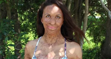 Turia Pitt debuts amazing post-baby body in new pic