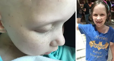 Cancer-stricken 8-year-old whose photo moved the world celebrates heartwarming news