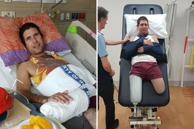 Father of two loses his legs after charging battery