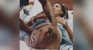Footage of a doctor ‘flipping’ a breech baby in the womb has gone viral