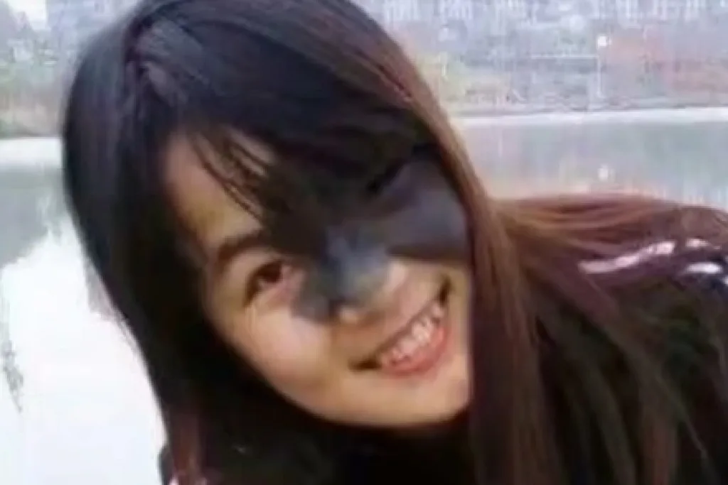 Doctors fear Xiao Yan's birthmark could be cancerous