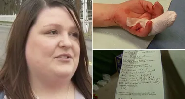 Mum accuses childcare staff of severing one-year-old daughter’s finger