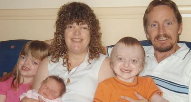 Woman with facial differences hits back at bullies