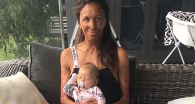 Turia Pitt shares adorable new pictures of her baby boy
