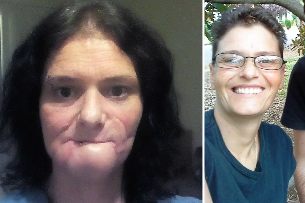 Me after the attack (right) compared to before (left)