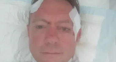 I was impaled by a tree branch