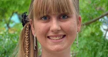The popular acne treatment that left this woman ‘vomiting blood’