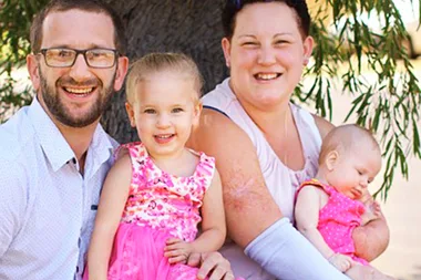 My hands were amputated – but that didn’t stop me from becoming a mum