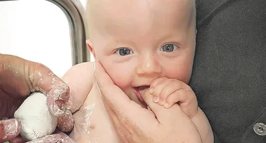 How could he lose his arm in the womb?