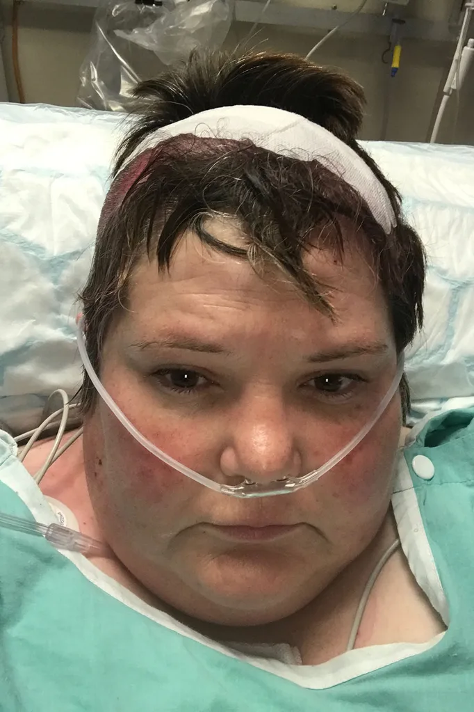 Waking up from surgery