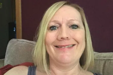 Woman has to take her nose off every night