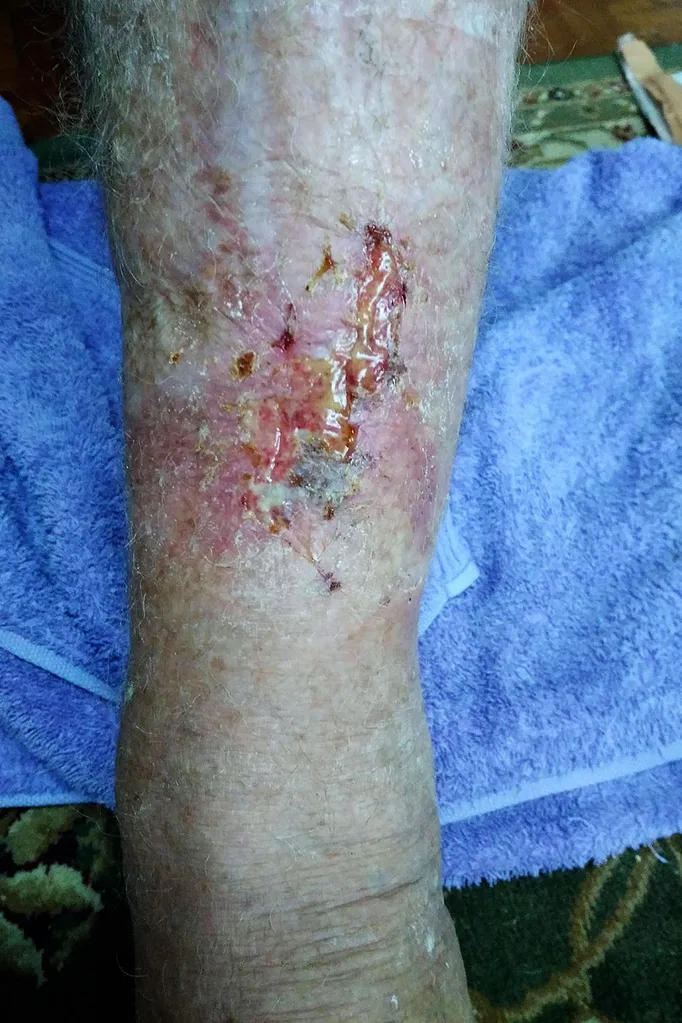 leg