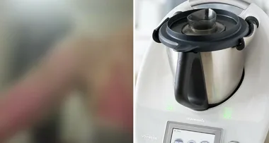 Aussie mum: My Thermomix burns horror