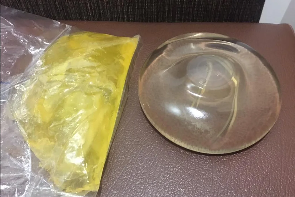 breast implants