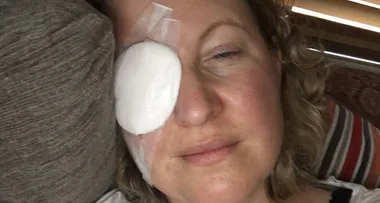 I was blinded by my contact lens!