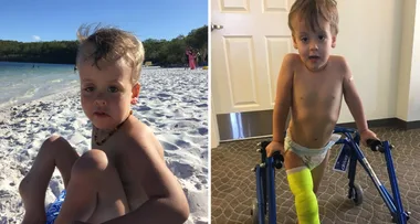 Amputation horror: how I saved my son’s leg