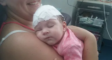 Our bub was born with a hole in her head