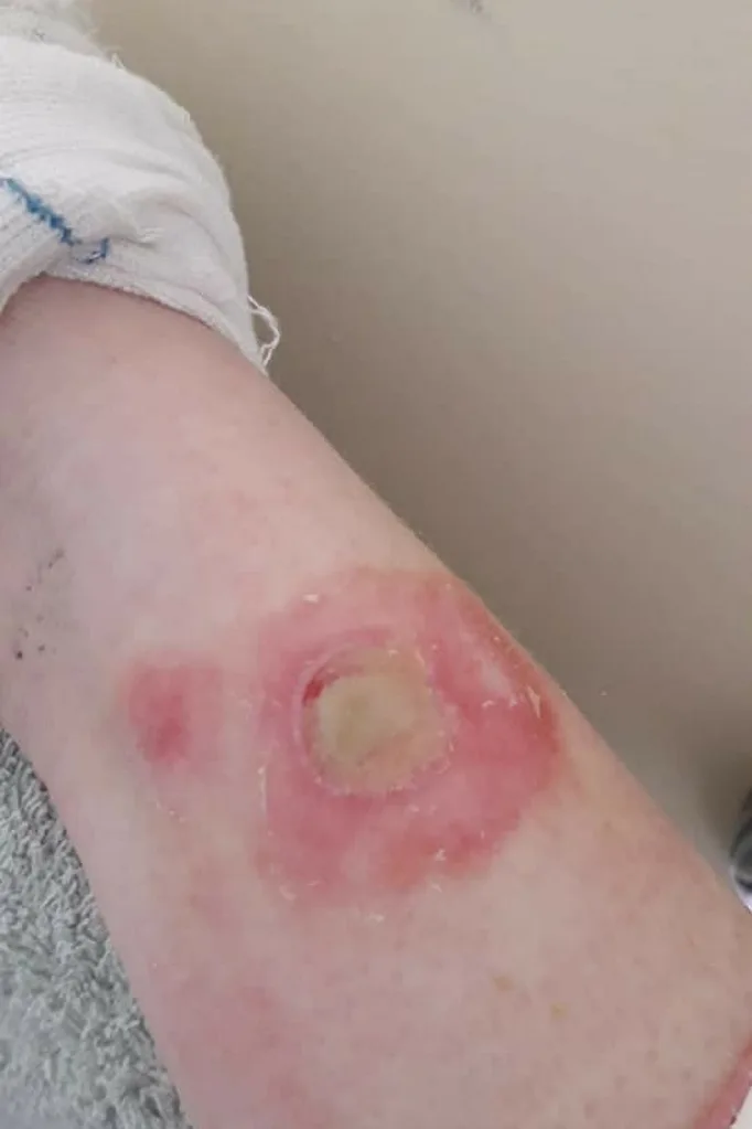 Ellie's injuries