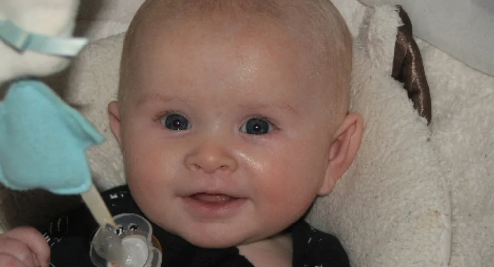 Baby Jordan Braddock who lost his fight with meningococcal B
