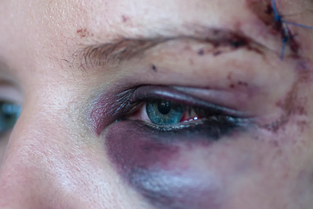 eye