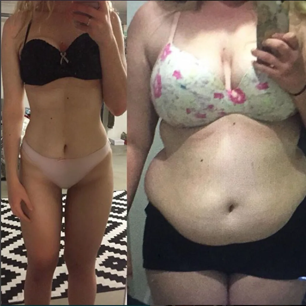 weight loss