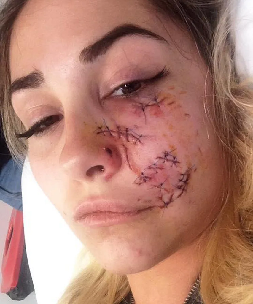 model mauled