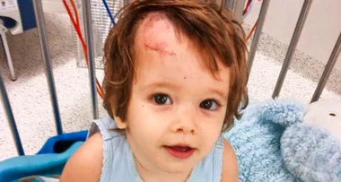 My toddler was sliced by a ceiling fan