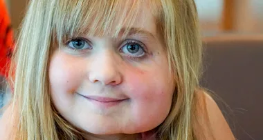 Mum paid $200,000 to fix her 8-year-old daughter’s face