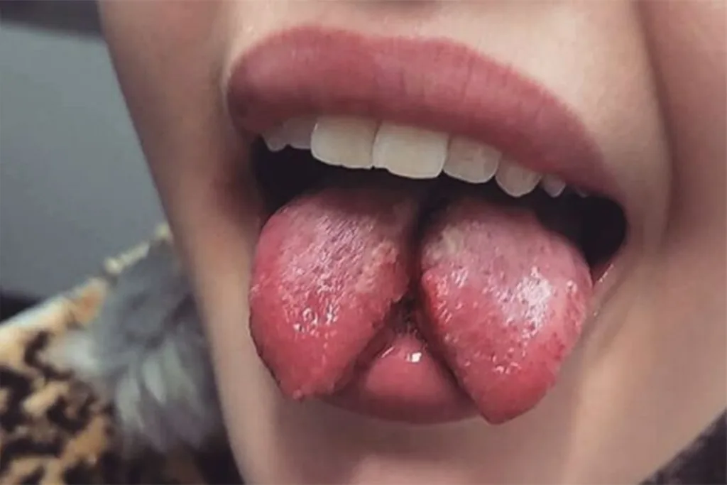 tongue