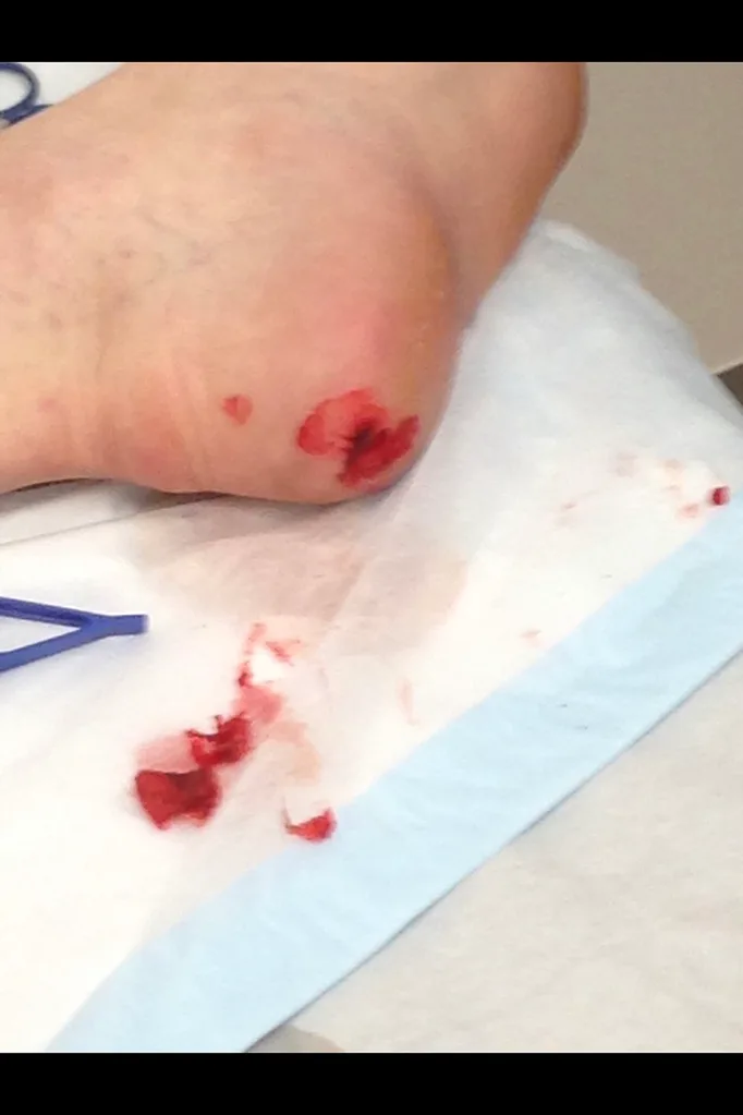 blood kept coming