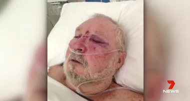 Grandfather bashed trying to stop street fight