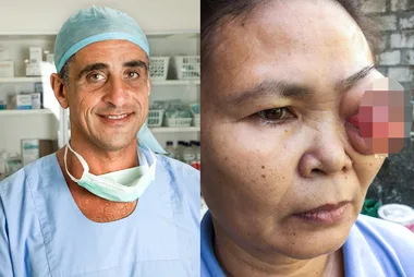 ‘I saved someone’s face while on holiday’