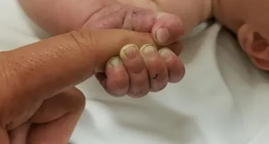 A baby buried in a forest has been found alive
