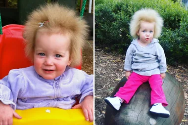 Rare genetic syndrome gives adorable kid INCREDIBLE uncombable locks