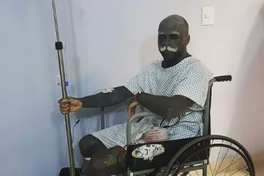 Man has GENITALS removed after tattooing 90 per cent of his body