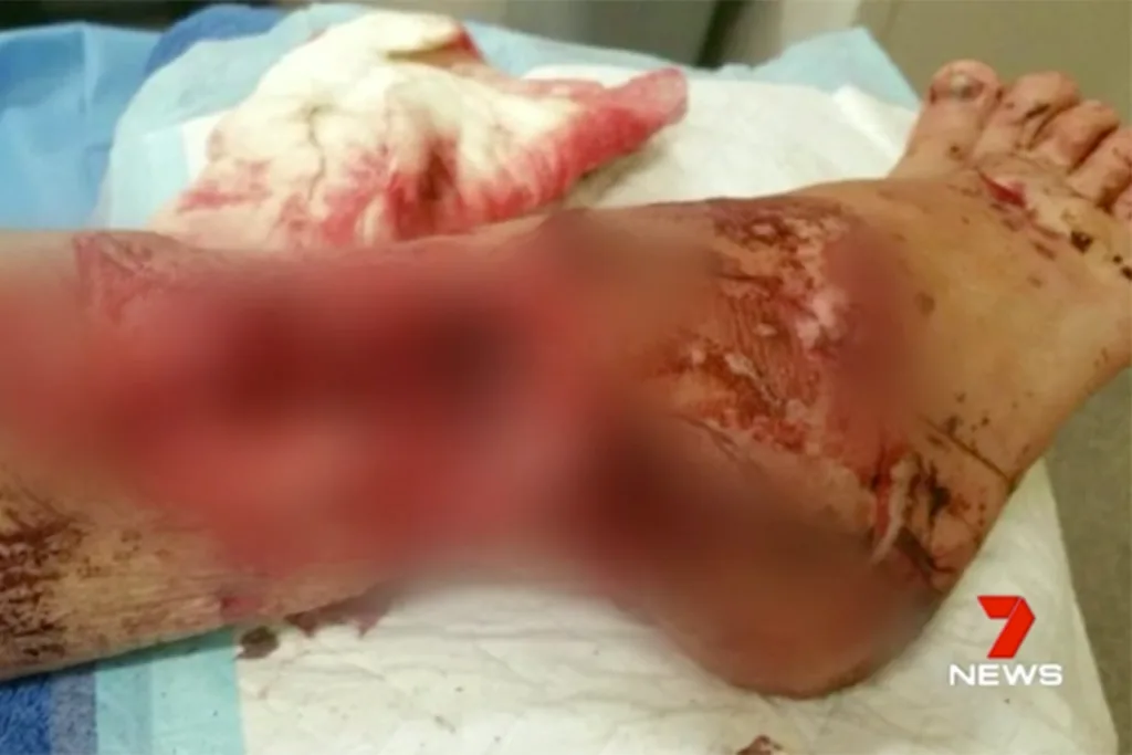 graphic attack