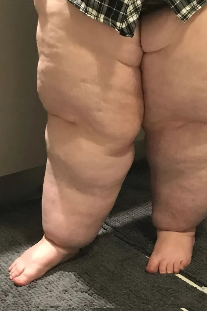 legs today