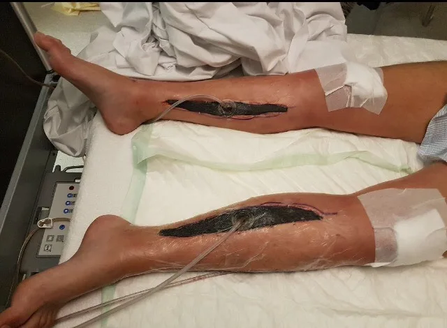 surgery