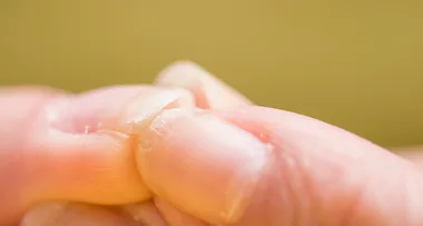Woman discovers her ‘ugly nails’ were actually an early warning sign of cancer