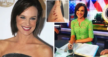 Channel 10 newsreader Natarsha Belling reveals shock injury