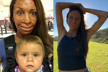 Turia Pitt: Don’t call me a burns victim!